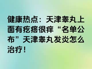 健康热点：天津睾丸上面有疙瘩很痒“名单公布”天津睾丸发炎怎么治疗！